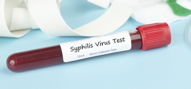 Sos malattie sessualmente trasmesse, Picco hiv tra over 50, +400% casi di sifilide