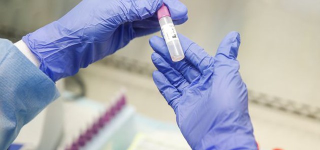 Coronavirus, dall'Olanda il primo farmaco in grado di neutralizzarlo