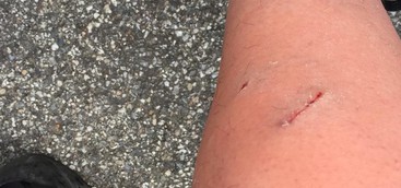 Catanzaro: cani in branco, aggredita giovane. I cittadini chiedono aiuto.