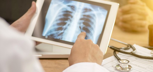 Tubercolosi, 2 mln i ragazzi colpiti ogni anno nel mondo