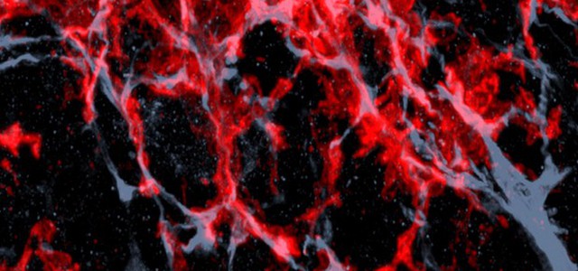 Scoperta la proteina che innesca la crescita dei tumori