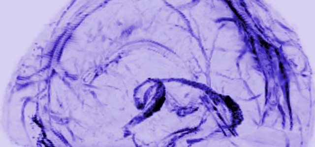 Scoperta la 'rete fognaria' del cervello, drena i rifiuti