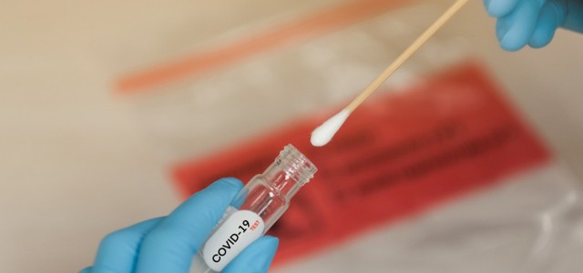 Covid - Confartigianato Catanzaro sui tempi infiniti degli esiti dei tamponi gratuiti: "I calabresi devono trovare anche i soldi per pagare i tamponi privatamente"