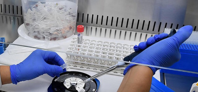 Covid, 2.600 tamponi trasferiti da Cosenza al Policlinico di Bari