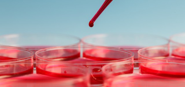 Verso un test del sangue per predire la leucemia anni prima dell'esordio