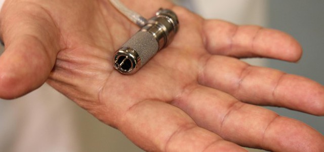 Un mini-cuore artificiale salva la vita ad una bambina di 3 anni