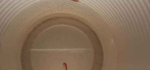 La denuncia di alcuni turisti: "Dai rubinetti insieme all'acqua escono i vermi"