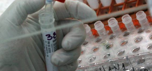 A 12 anni rifiuta la chemio in Olanda, giudice gli da' ragione