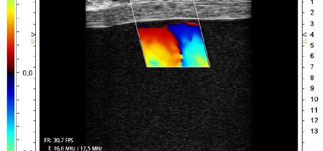 L’occhio bionico in aiuto al cardiochirurgo: una nuova tecnologia al servizio del cittadino 