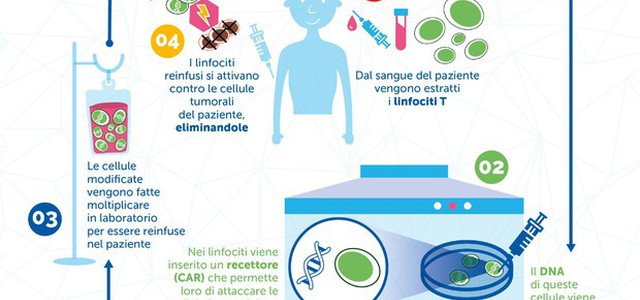 Scompare leucemia in bimbo curato con cellule 'riprogrammate'