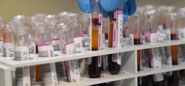 Falsifica oltre 270 rapporti su alimenti, interdetto tecnico nel Cosentino