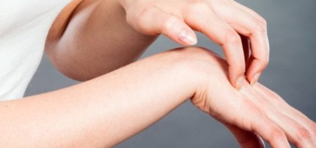 Psoriasi, in tutta la Calabria "visite" online gratuite il 28 ottobre grazie alla campagna "Impatto invisibile"
