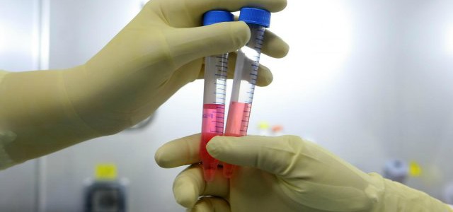 Dal Cnr di Rende arriva una speranza per la cura del tumore al pancreas