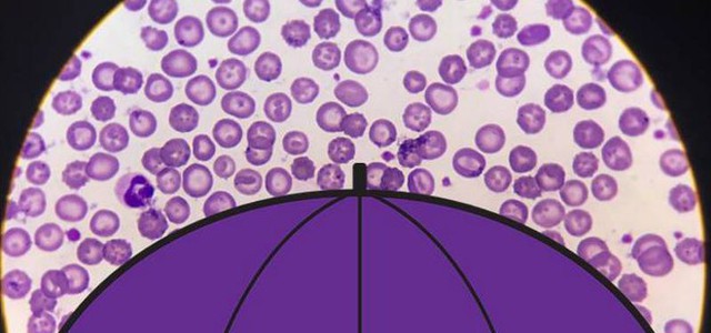 Virus piovono dal cielo, centinaia di milioni a metro quadro