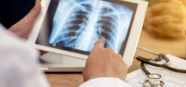 Asp Catanzaro: evento scientifico per la XI edizione del TB DAY