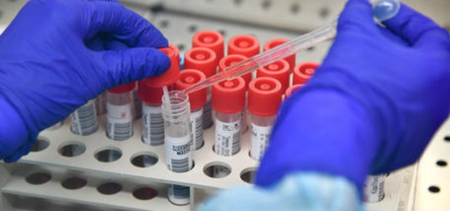 Coronavirus, zero contagi in Calabria. I migliori in Europa.