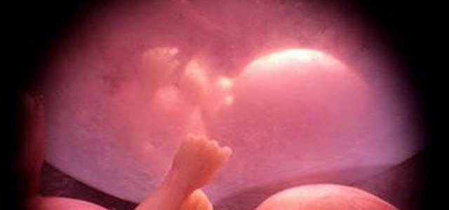 Trasfusioni e trapianto in utero, prima volta al mondo