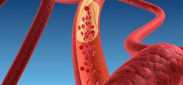 Screening gratuito sull’Ipercolesterolemia familiare