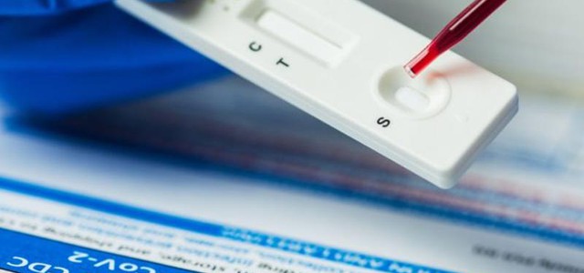 Appello dell'assessore Savaglio al personale della scuola ad effettuare i test sierologici