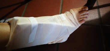 Manca il materiale al pronto soccorso, ingessatura di cartone all'ospedale di Soveria Mannelli